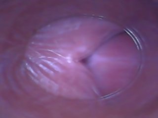 Kira - poredno sebek (endoscope muca kamera video)