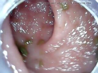 পায়ুপথ endoscope অংশ 1, বিনামূল্যে মলদ্বারে তরল ঢূকানো শাস্তি এইচ ডি নোংরা চলচ্চিত্র 04 | xhamster